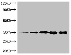 6*His 單克隆抗體 (CSB-MA000011M0m)