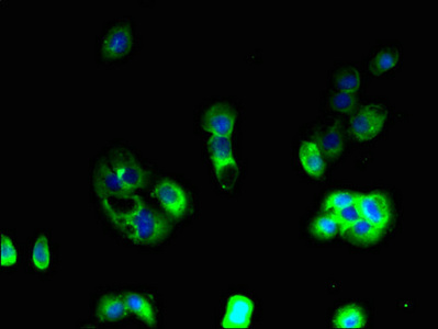 CSB-PA001910EA01HU
