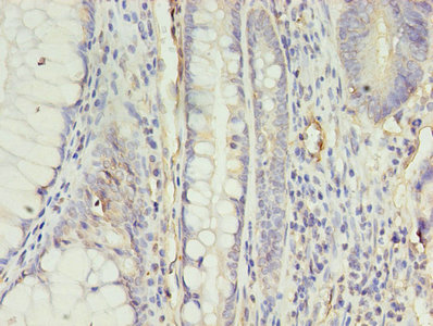 CSB-PA001910EA01HU