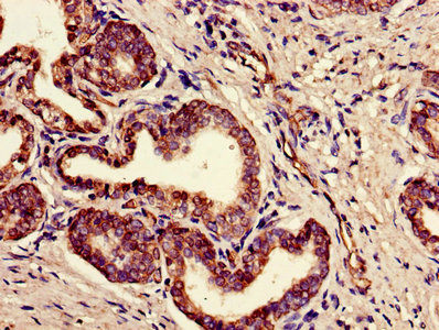 CSB-PA008227LA01HU