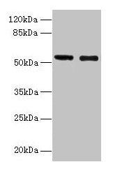 CSB-PA009514YA01HU