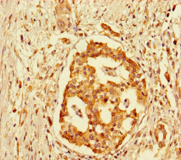 CSB-PA009792LA01HU