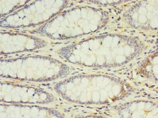 CSB-PA011629LA01HU