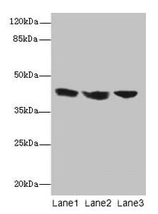 CSB-PA011651EA01HU