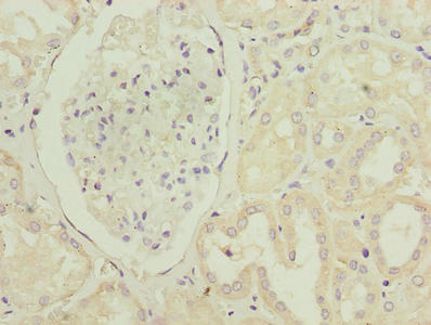 CSB-PA018946LA01HU