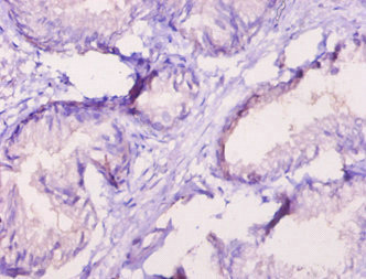 CSB-PA020067LA01HU