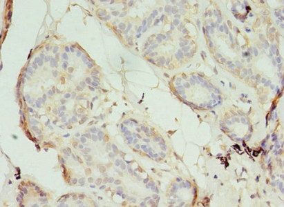 CSB-PA020650LA01HU