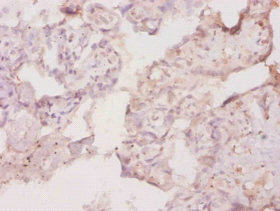 CSB-PA07779A0Rb IHC