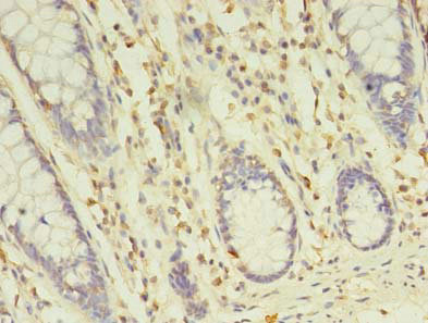 CSB-PA729201LA01HU