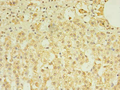CSB-PA729201LA01HU