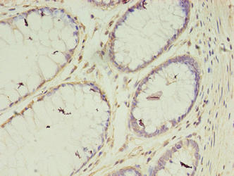CSB-PA769783EA01HU