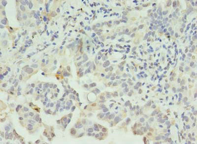 CSB-PA843319LA01HU