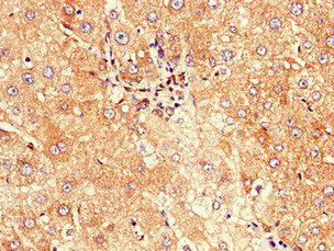 CSB-PA850816LA01HU