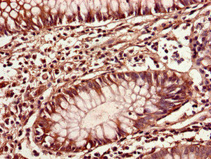 CSB-PA863991LA01HU