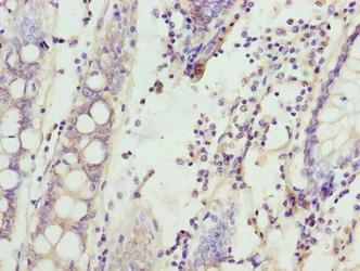 CSB-PA865142LA01HU