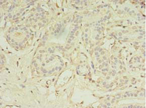 CSB-PA875636LA01HU