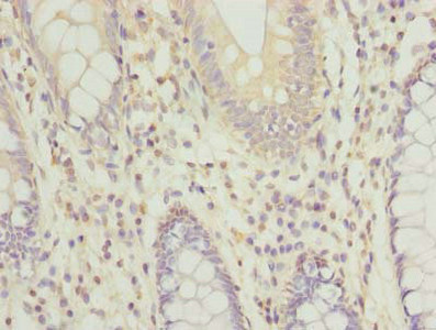 CSB-PA878854HA01HU