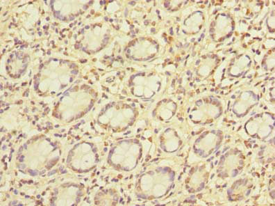 CSB-PA884471LA01HU