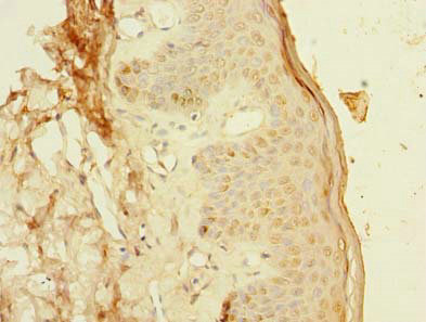 CSB-PA884471LA01HU