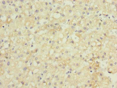 CSB-PA892325LA01HU