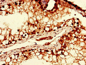 CSB-PA896902LA01HU