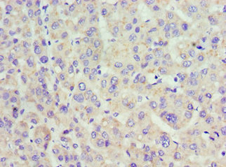 CSB-PA001176ESR2HU