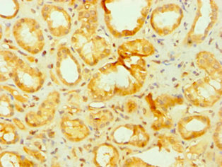 CSB-PA001912DSR2HU
