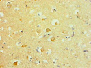 CSB-PA001912DSR2HU