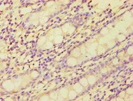 CSB-PA002761ESR1HU