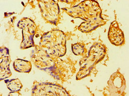 CSB-PA002761ESR1HU