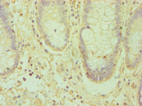 CSB-PA007460ESR1HU
