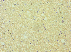 CSB-PA007460ESR1HU