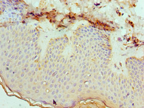 CSB-PA007466ESR2HU