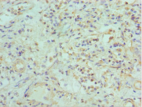 CSB-PA007466ESR2HU