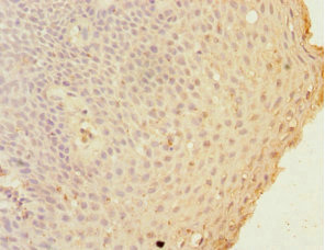 CSB-PA009307DSR1HU