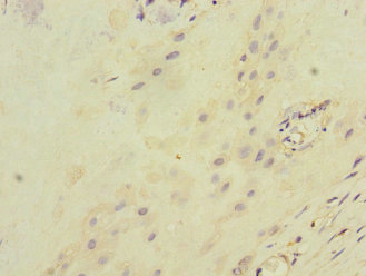 CSB-PA011892ESR1HU