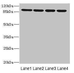 CSB-PA011892ESR1HU