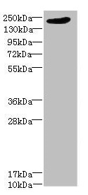 CSB-PA013099ESR1HU