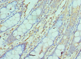 CSB-PA015521ESR1HU