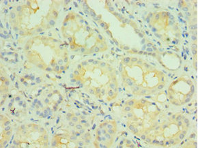 CSB-PA015542ESR1HU