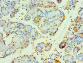 CSB-PA015542ESR1HU
