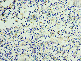 CSB-PA015956ESR2HU