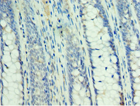 CSB-PA021788ESR2HU
