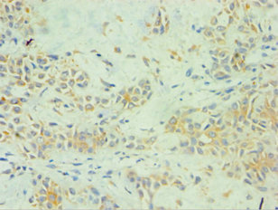 CSB-PA022584ESR1HU