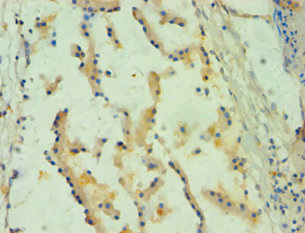 CSB-PA022584ESR1HU