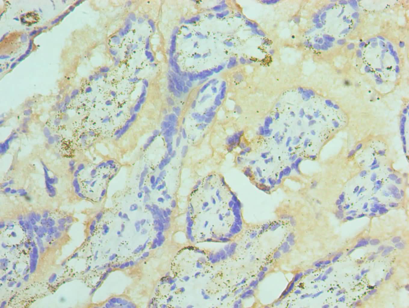 CSB-PA022746ESR1HU