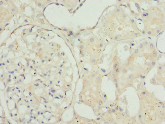 CSB-PA023106DSR1HU