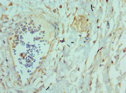 CSB-PA023987ESR1HU
