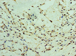CSB-PA026425DSR2HU