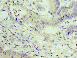 CSB-PA026425DSR2HU
